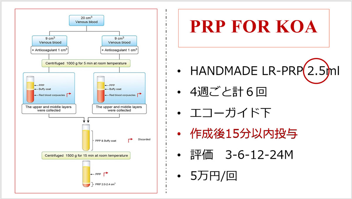 PRP FOR KOA