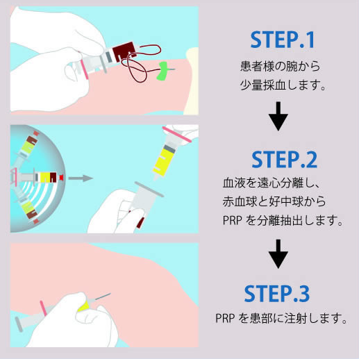 院長コメントのイラスト(1)